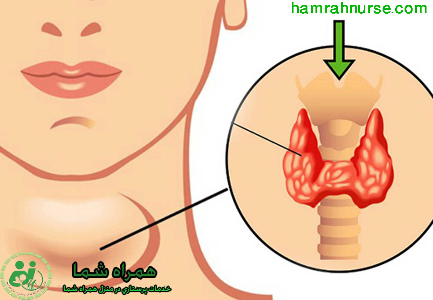 علائم و خطرات تیروئید کم کار