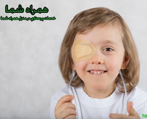 تنبلی چشم کودکان