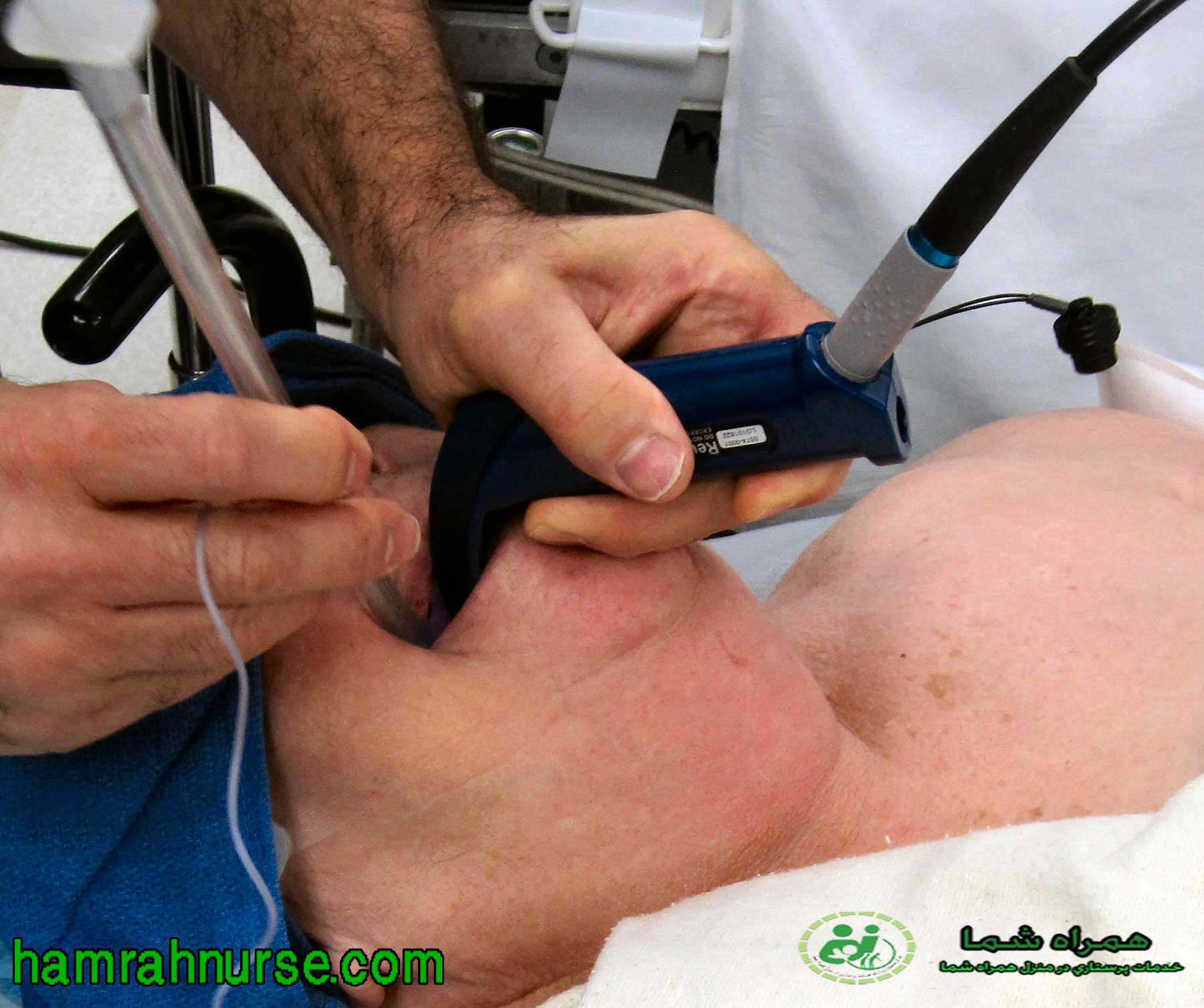 آشنایی با اینتوبه و موارد استفاده وخطرات آن