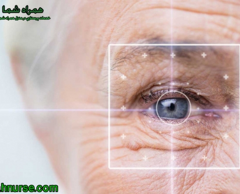 مراقبت های لازم بعد از عمل آب مروارید