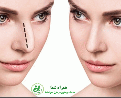 عوارض جراحی بینی