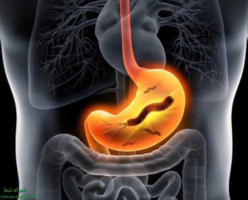 آنچه باید درباره ی میکروب معده بدانیم