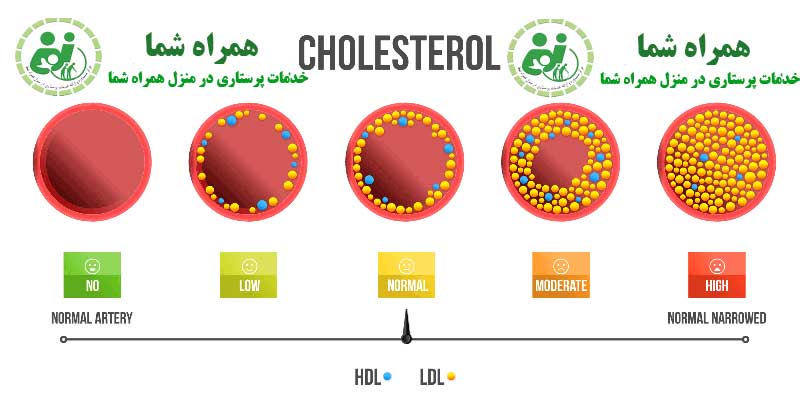 چربی خون بالا علائم و راه های تشخیص و درمان آن