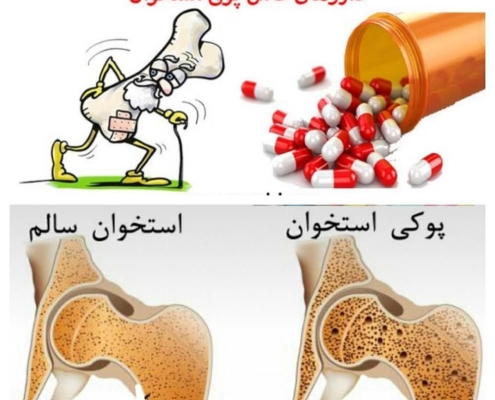 داروهای عامل پوکی استخوان