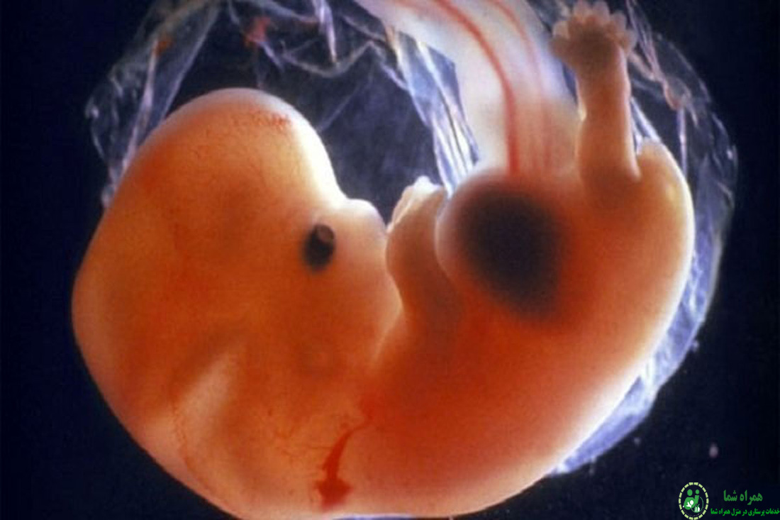 فریز نمودن تخمک چگونه است؟