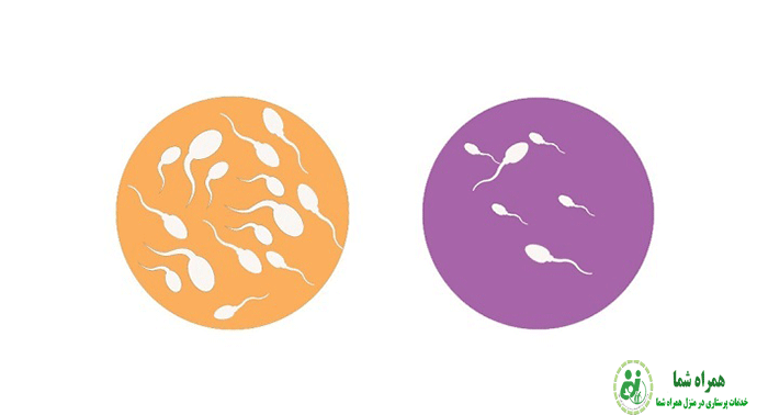 آزواسپرمی