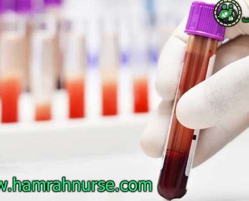 چگونه نتایج آزمایش خود را بفهمیم؟