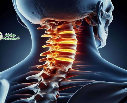 سرویکال گردن چیست؟