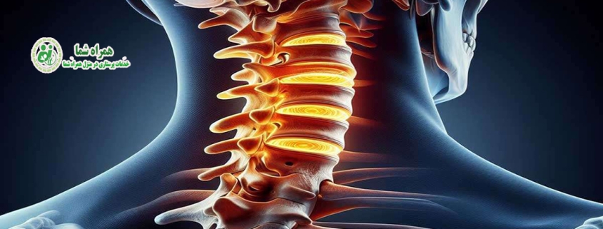 سرویکال گردن چیست؟
