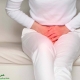 شب ادراری در بانوان