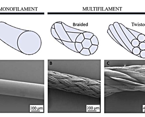 تفاوت بخیه جذبی و غیرجذبی