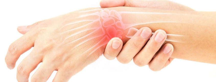 جراحی تاندون مچ دست و مراقبت‌های پس از آن