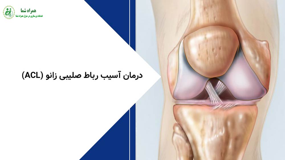 پارگی رباط صلیبی زانو